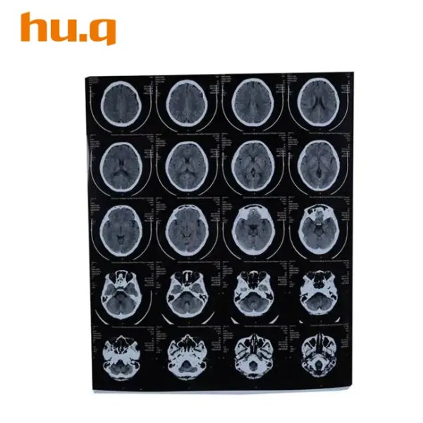 HQ-KX410 Medical Dry Film 8 x 10 in.(20 x 25 cm)